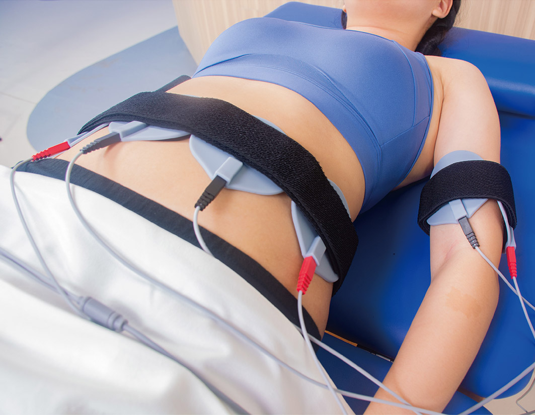 Electrical Stimulation